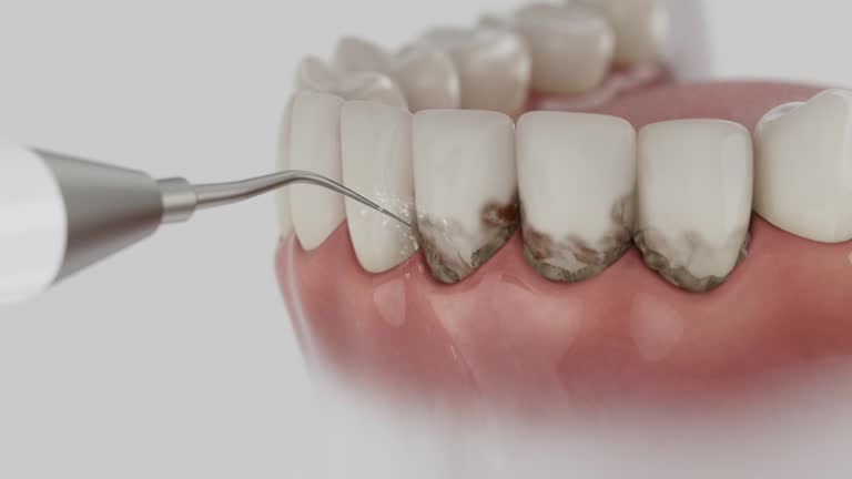 Reliable Emergency Dentist contractor in Von Ormy, TX by Smile Center Dentistry